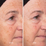 HydroPeptide Liquid Resurfacing Solution