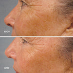 HydroPeptide LumaPro-C Serum