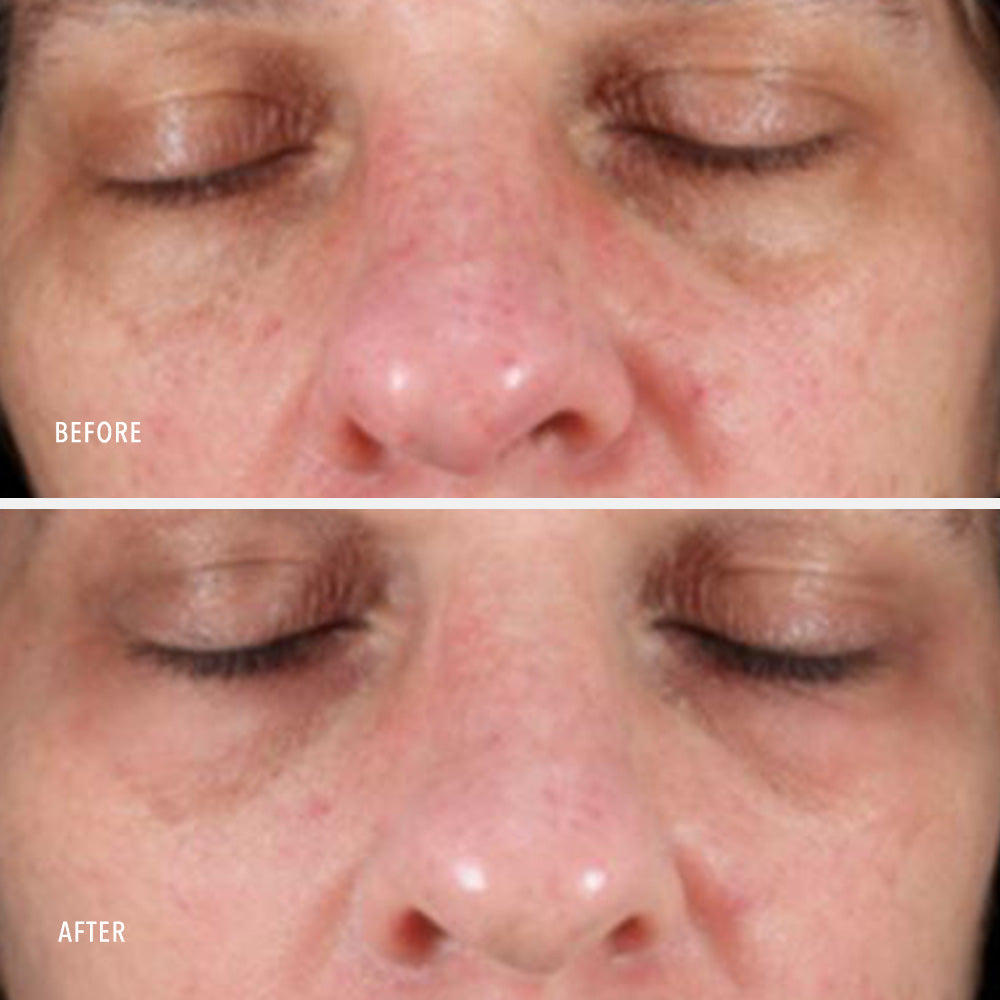 HydroPeptide Collagen ReActivate PM