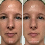 HydroPeptide Polish & Plump Face Peel