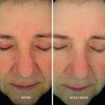 HydroPeptide Soothing Serum