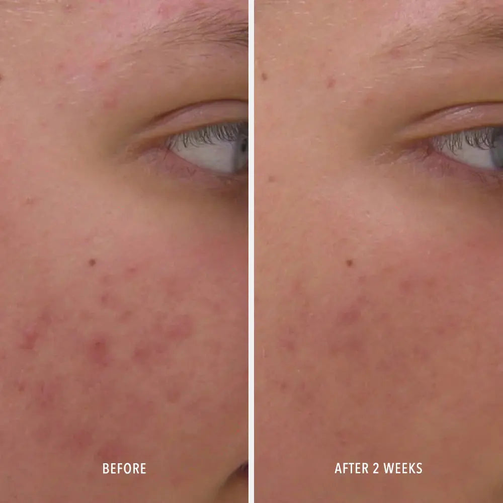 Hydropeptide Clear Rescue