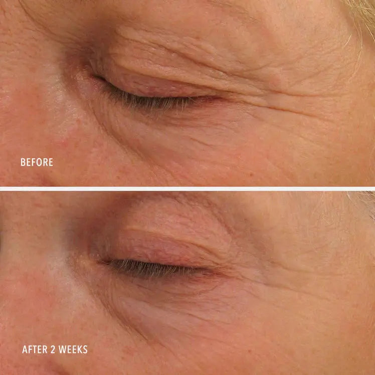 BB Balance Eye Authority