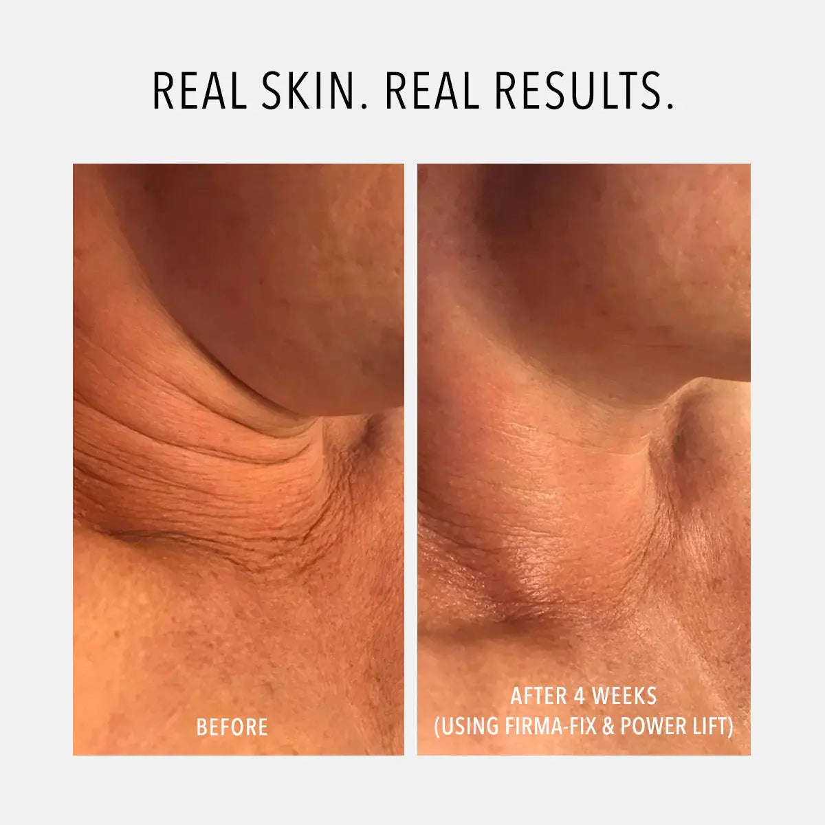 Hydropeptide Firma-Fix Nectar