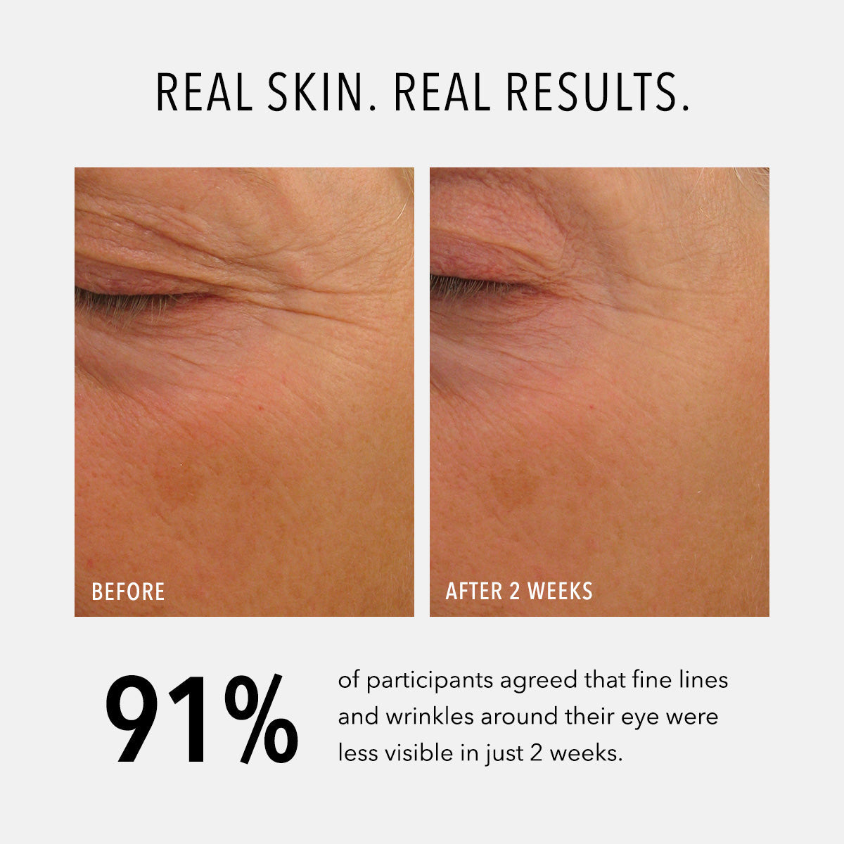 HydroPeptide Eye Authority