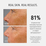 HydroPeptide LumaPro-C Serum