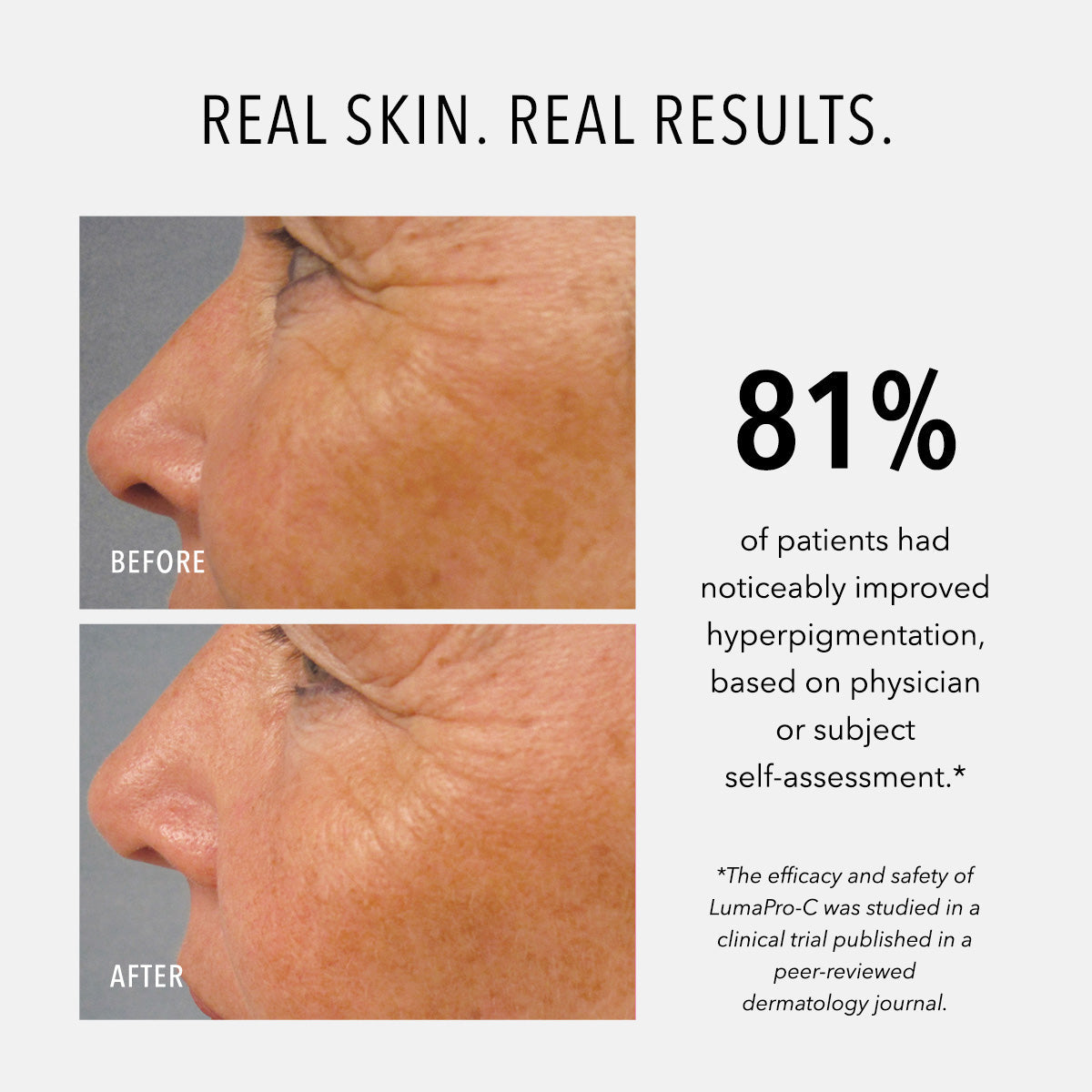 HydroPeptide LumaPro-C Serum