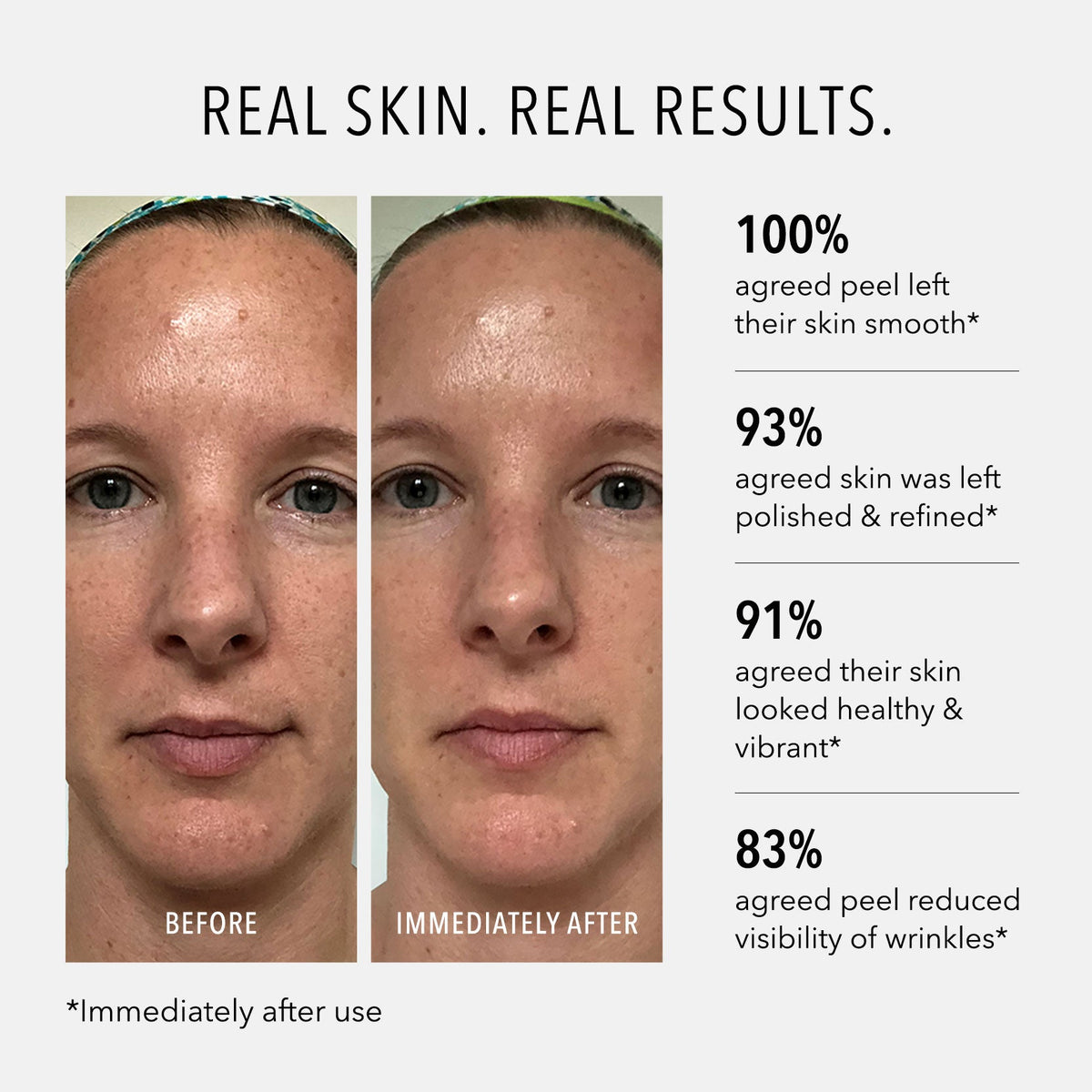 HydroPeptide Polish & Plump Face Peel