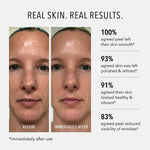 HydroPeptide Polish & Plump Face Peel