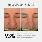 HydroPeptide Soothing Serum