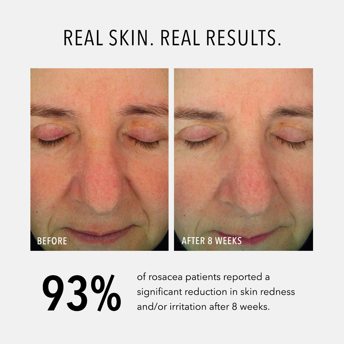 HydroPeptide Soothing Serum