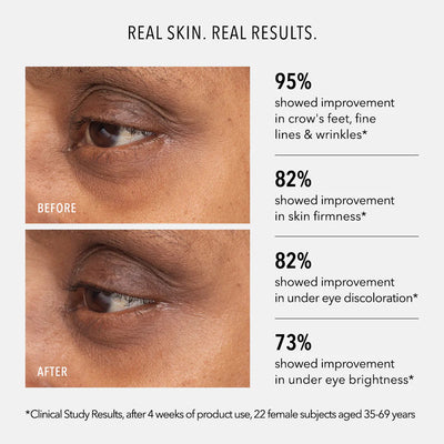 Hydropeptide Retinol Eye Renewal Product vendor