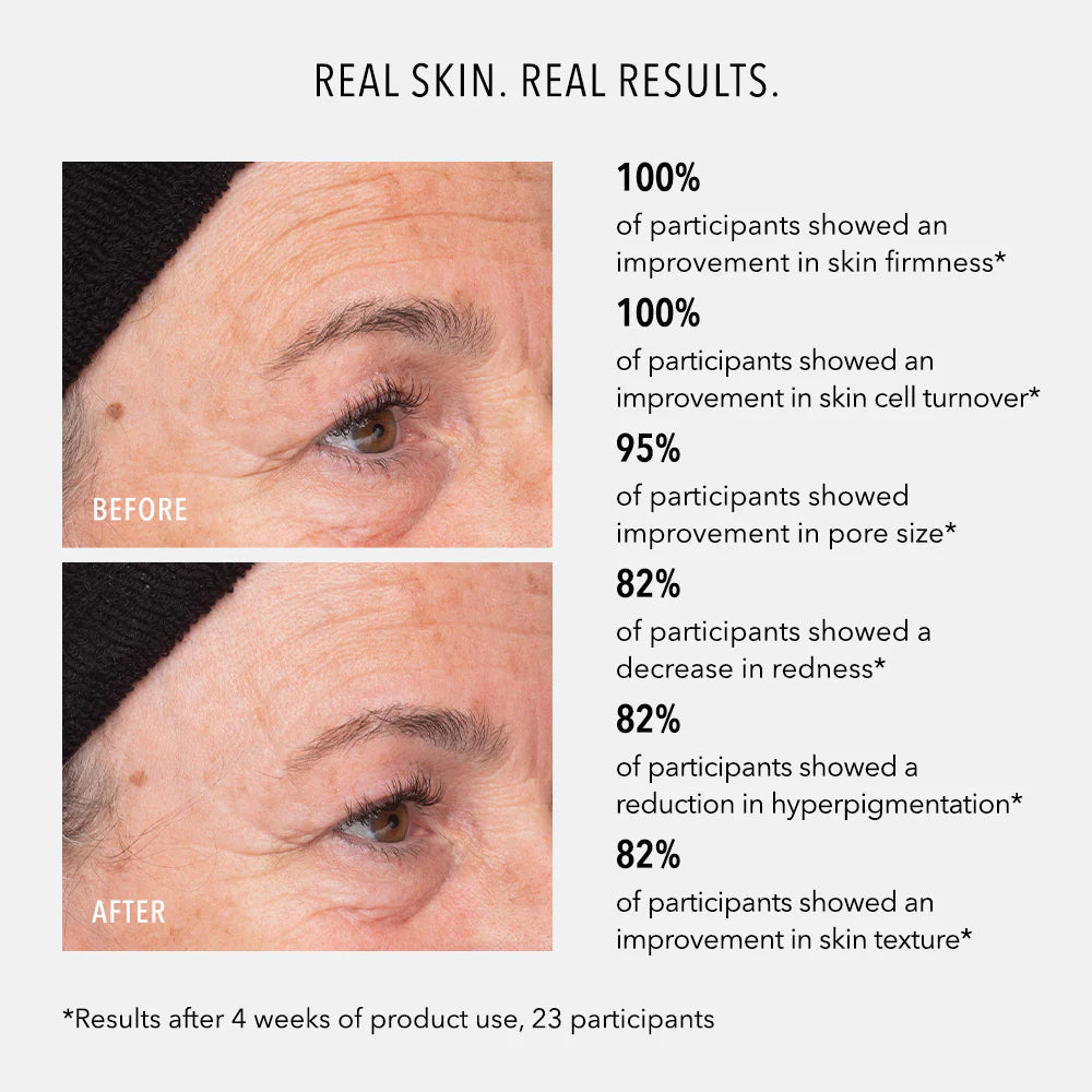 Hydropeptide Liquid Resurfacing Solution