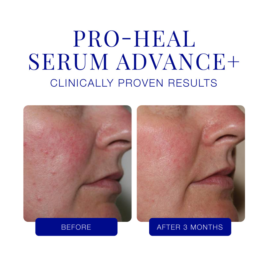 Pro-Heal Serum Advance+