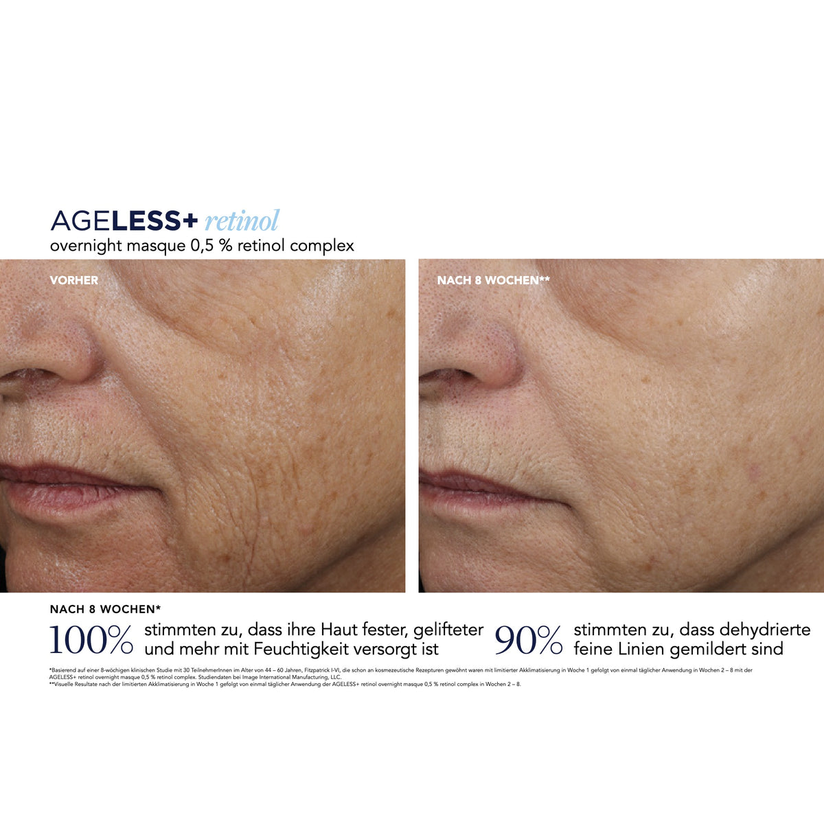 AGELESS+ Retinol Overnight Masque 0,5 % Retinol Complex – Ergebnisse der klinischen Studie