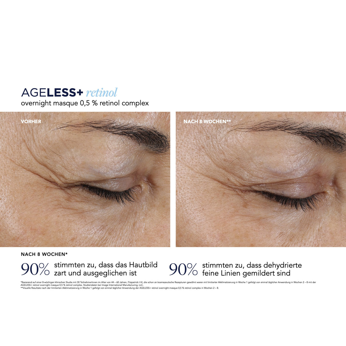 AGELESS+ Retinol Overnight Masque 0,5 % Retinol Complex – Ergebnisse der klinischen Studie