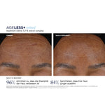 AGELESS+ Retinol Treatment Crème 1,2 % Retinol Complex – Ergebnisse der klinischen Studie