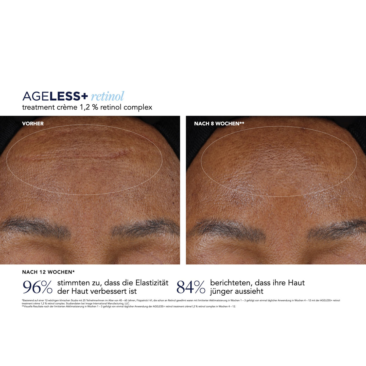 AGELESS+ Retinol Treatment Crème 1,2 % Retinol Complex – Ergebnisse der klinischen Studie