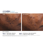 AGELESS+ Retinol Treatment Crème 1,2 % Retinol Complex – Ergebnisse der klinischen Studie