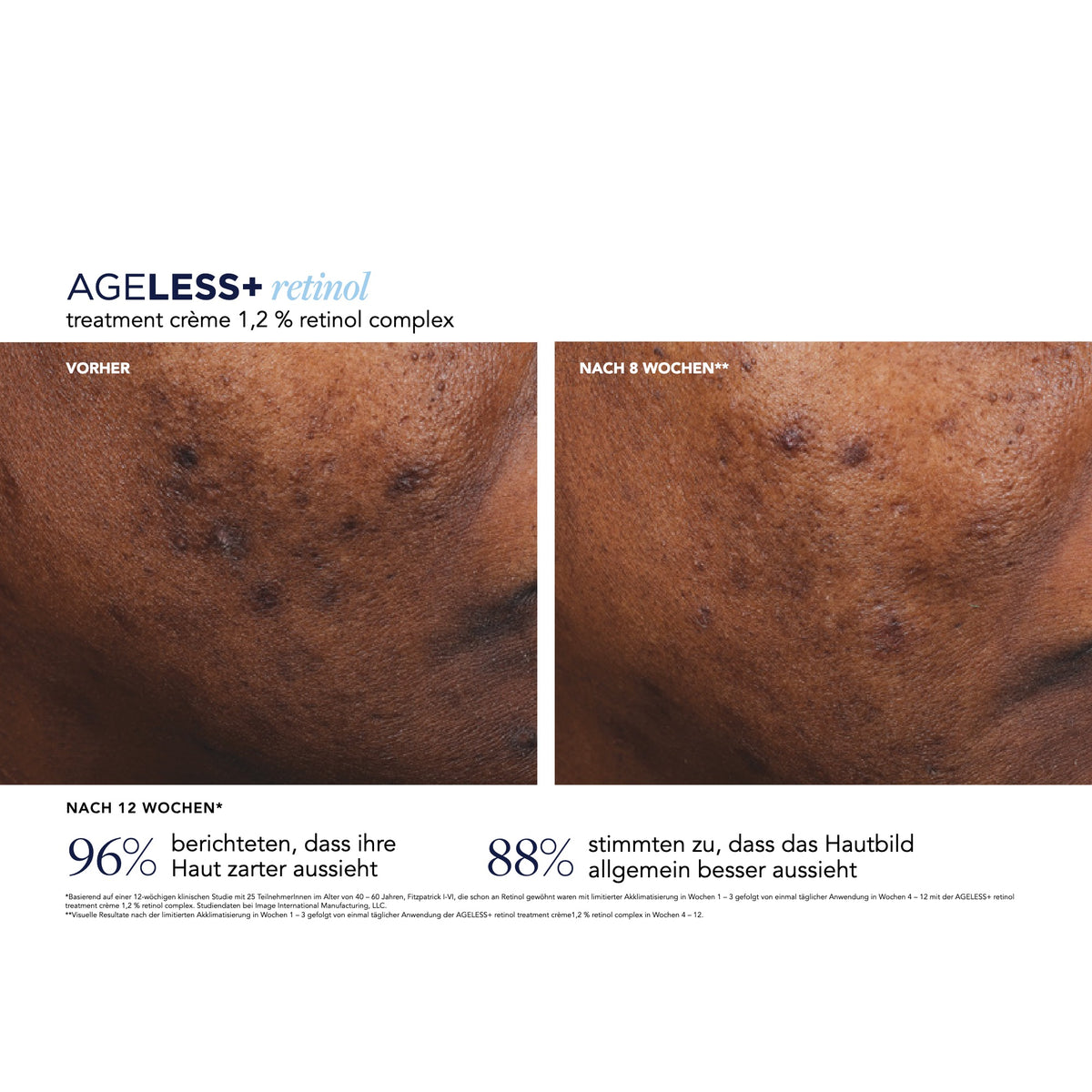 AGELESS+ Retinol Treatment Crème 1,2 % Retinol Complex – Ergebnisse der klinischen Studie