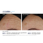 AGELESS+ Retinol Pure Liquid Retinol 0,1 % – Ergebnisse der klinischen Studie