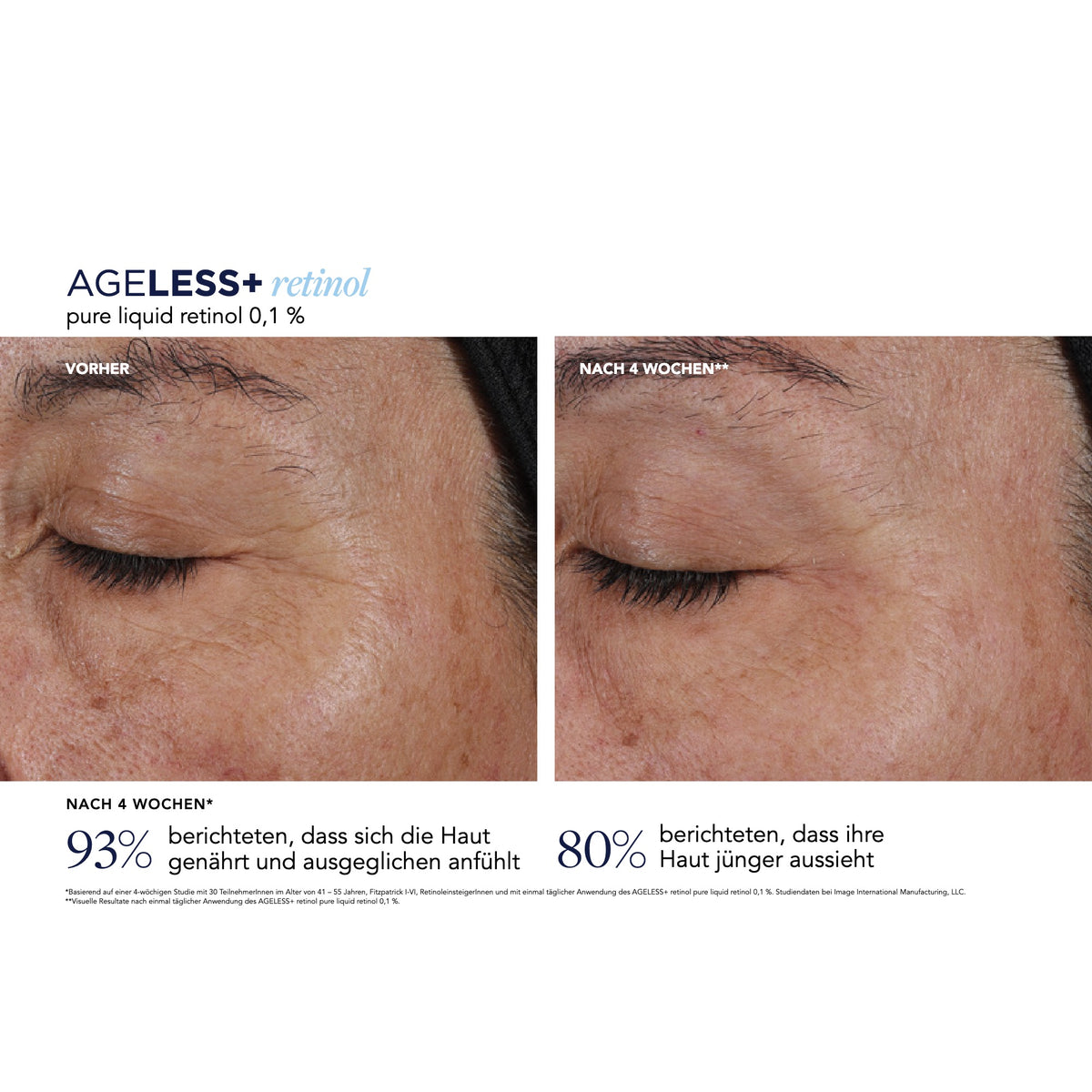 AGELESS+ Retinol Pure Liquid Retinol 0,1 % – Ergebnisse der klinischen Studie