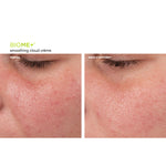 BIOME+™ Smoothing Cloud Crème – Ergebnisse der klinischen Studie