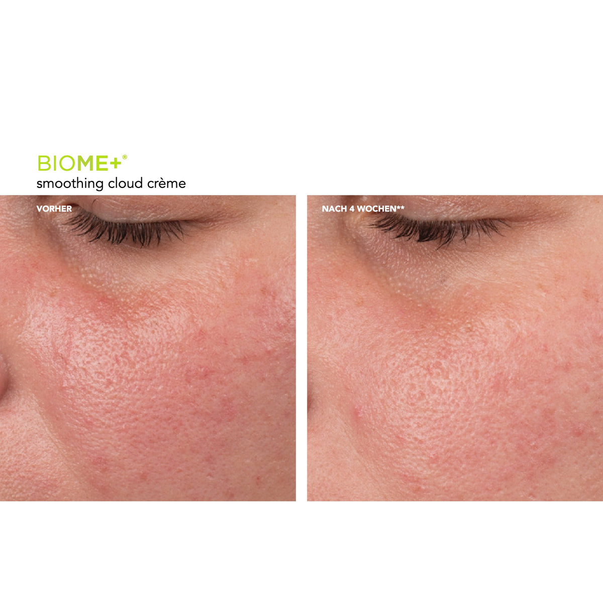 BIOME+™ Smoothing Cloud Crème – Ergebnisse der klinischen Studie