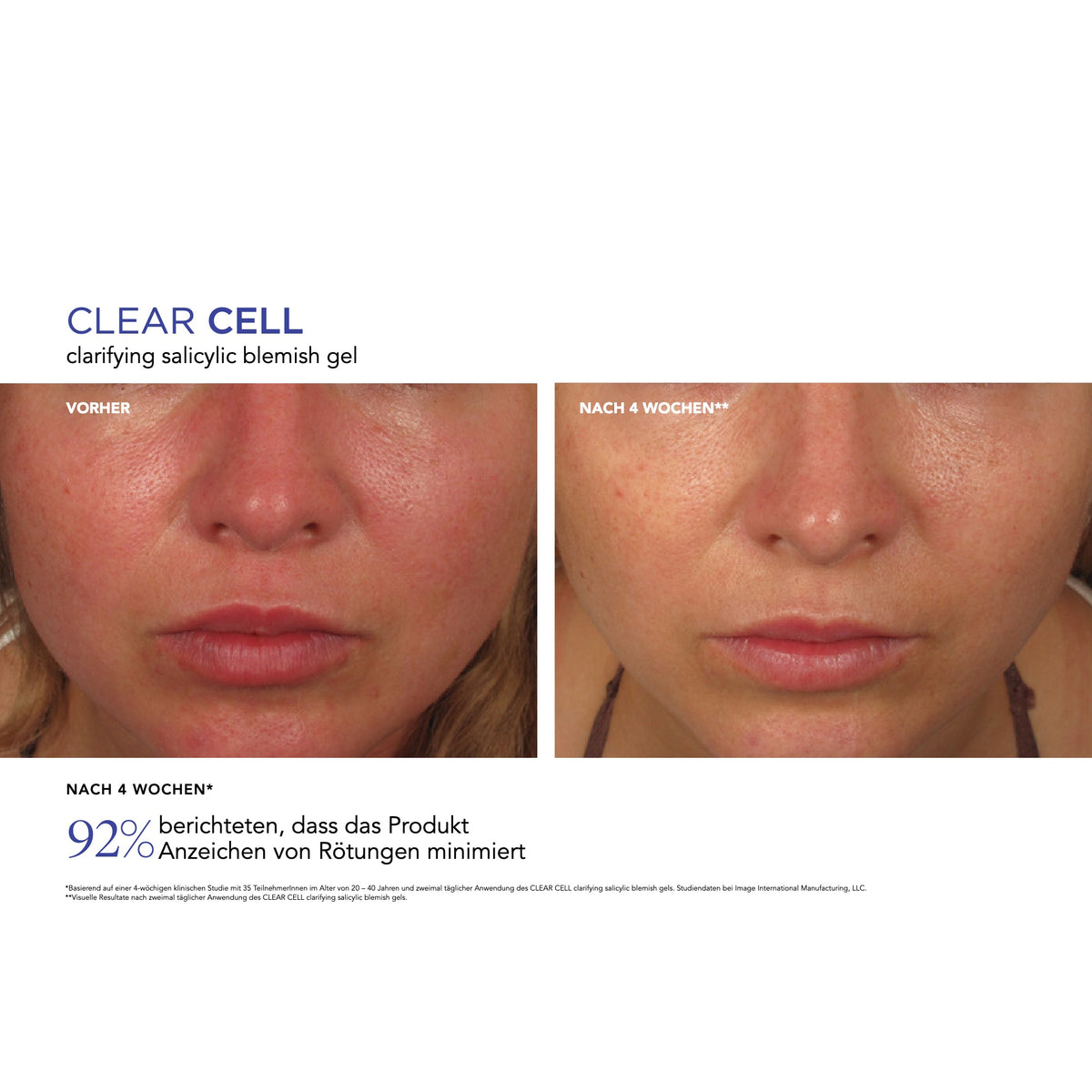 CLEAR CELL Clarifying Salicylic Blemish Gel – Ergebnisse der klinischen Studie