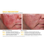 DAILY PREVENTION Advanced Smartblend Mineral Moisturizer SPF 50+ – Ergebnisse der klinischen Studie