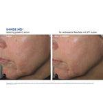 IMAGE MD Restoring Power-C Serum – Ergebnisse der klinischen Studie