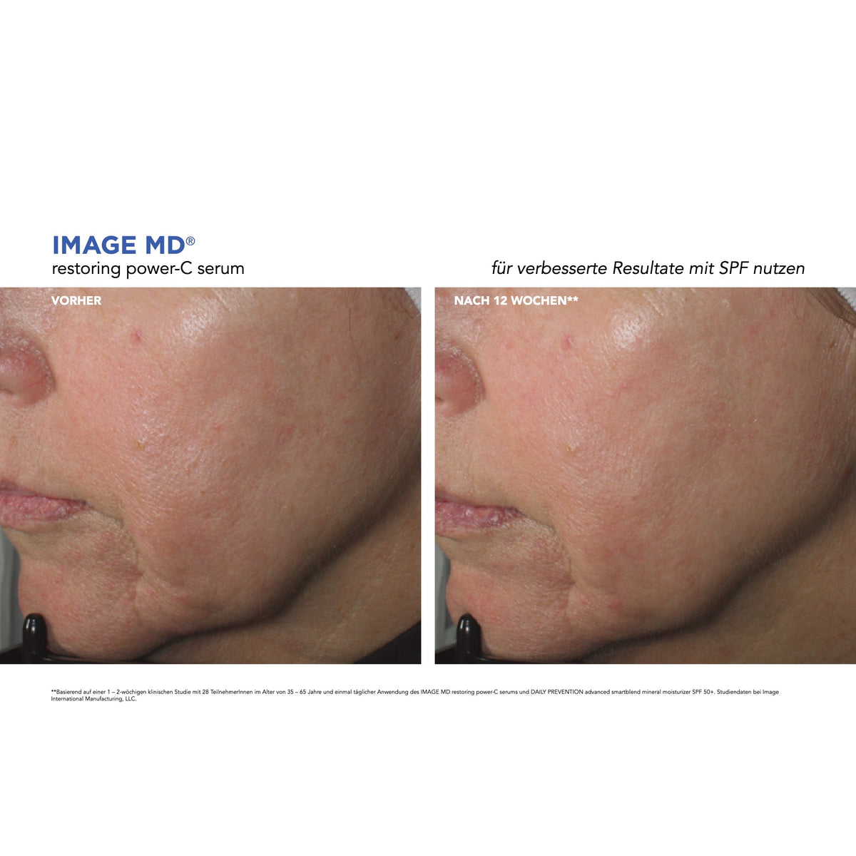IMAGE MD Restoring Power-C Serum – Ergebnisse der klinischen Studie