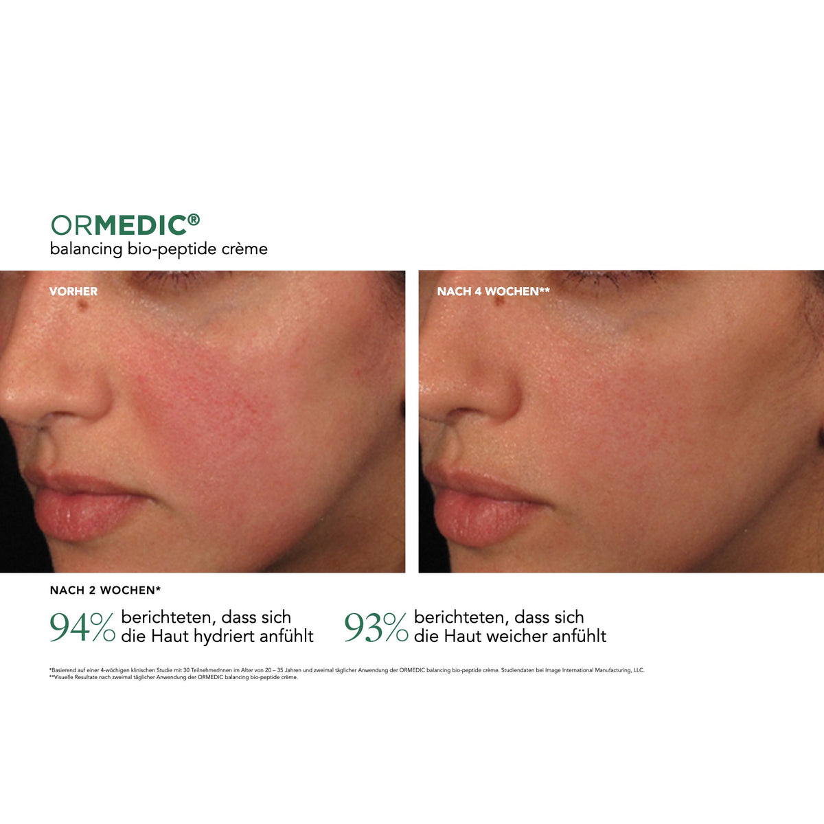 ORMEDIC® Balancing Bio-Peptide Crème – Ergebnisse der klinischen Studie