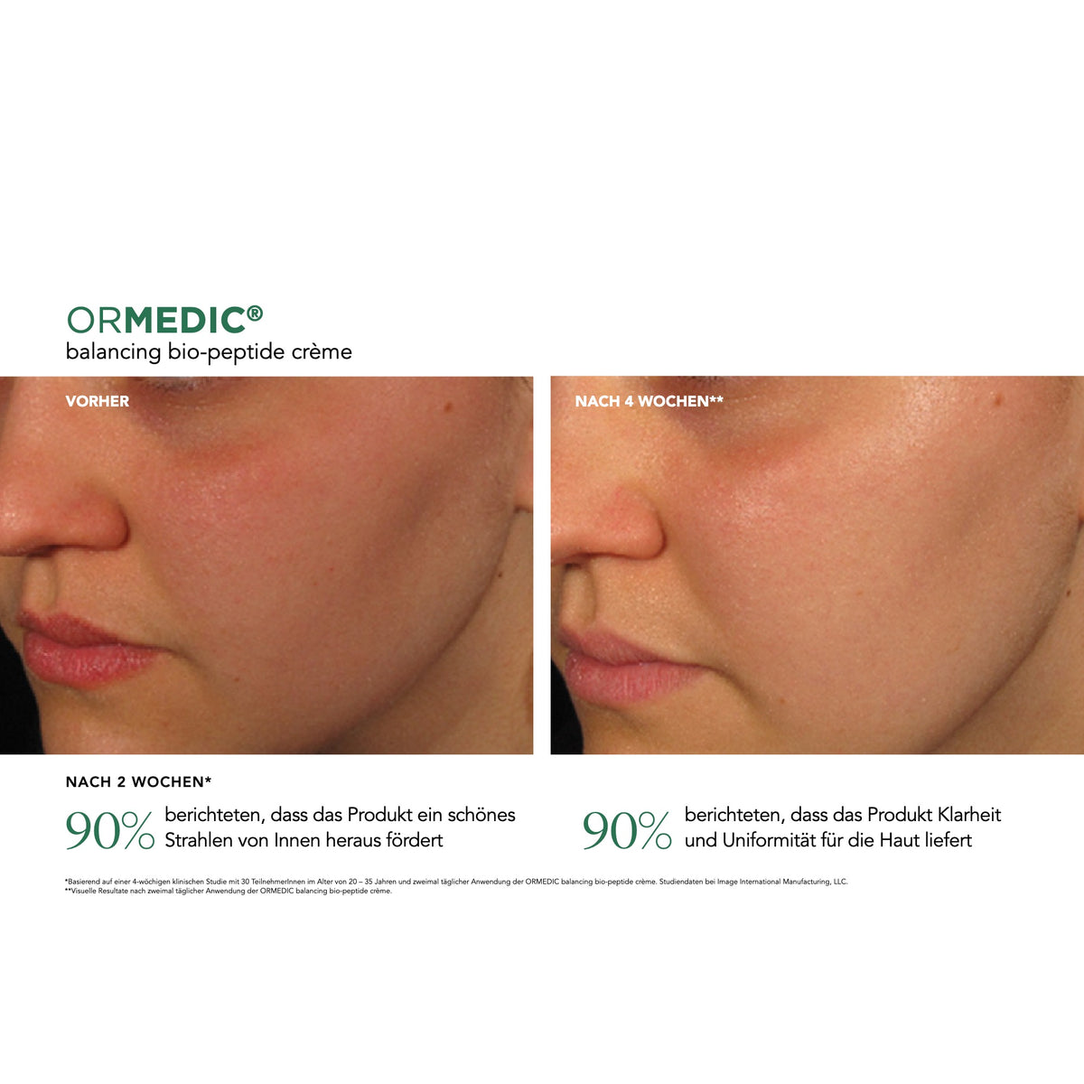 ORMEDIC® Balancing Bio-Peptide Crème – Ergebnisse der klinischen Studie