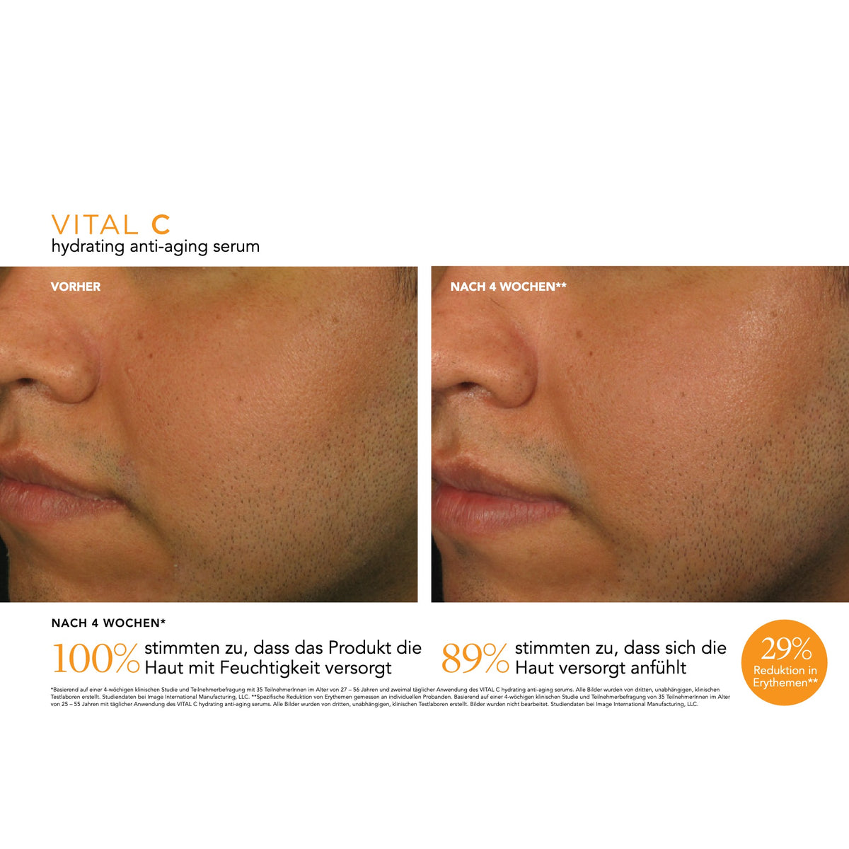 VITAL C Hydrating Anti-Aging Serum – Ergebnisse der klinischen Studie