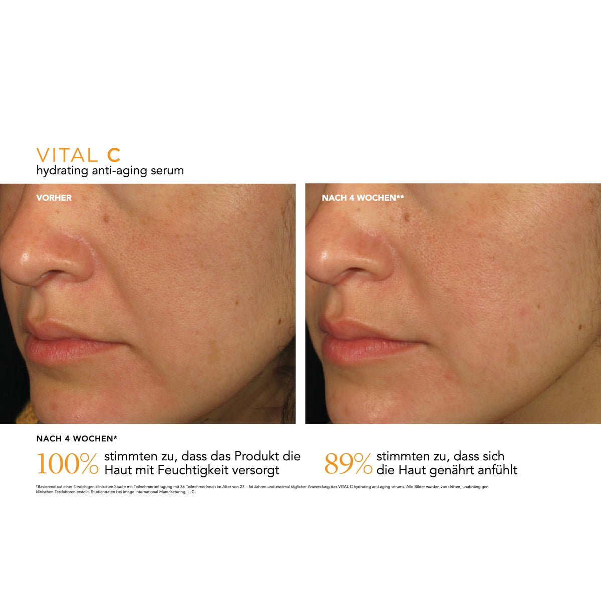 VITAL C Hydrating Anti-Aging Serum – Ergebnisse der klinischen Studie